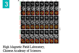 Figure of immunofluorescence