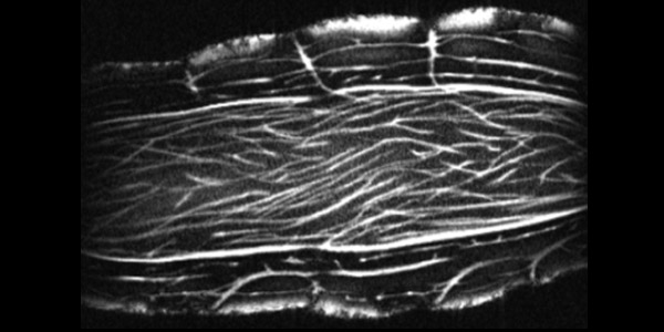 Turmeric MRI image