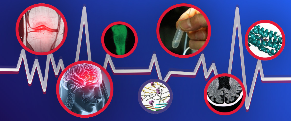 Image of seven ways the MagLab is advancing health research - neurogenerative disease stroke migraine cancer drug resistant bacteria cartilage fungal infections