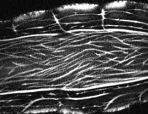 Reveal veggie MRI thumbnail