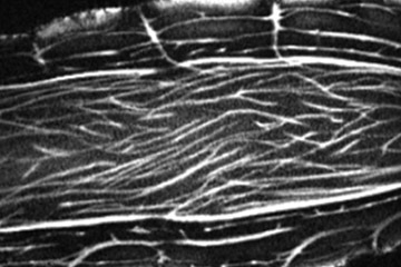vegetable in MRI