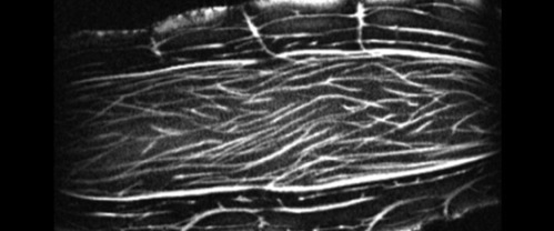 Reveal veggie MRI