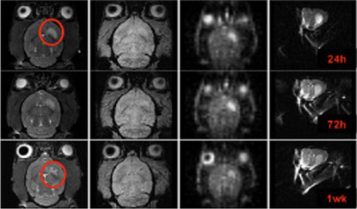MRI image of rat brain