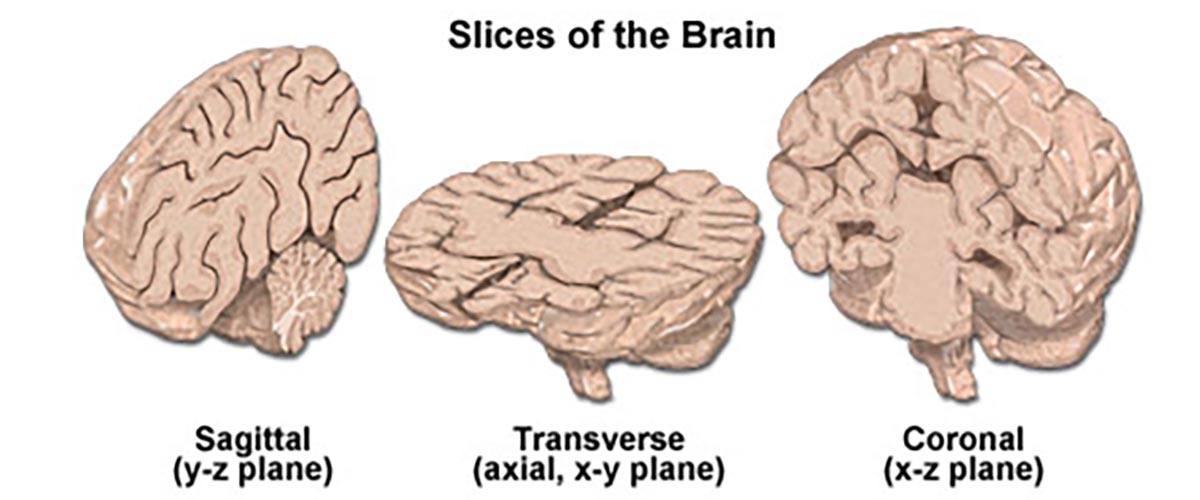 Slices of brain