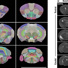 Anatomical MRI of representative Acomys brains.